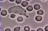 White Blood Cell Chases Bacteria Eats It 